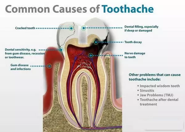 tooth a