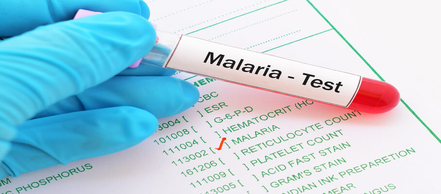 malaria test