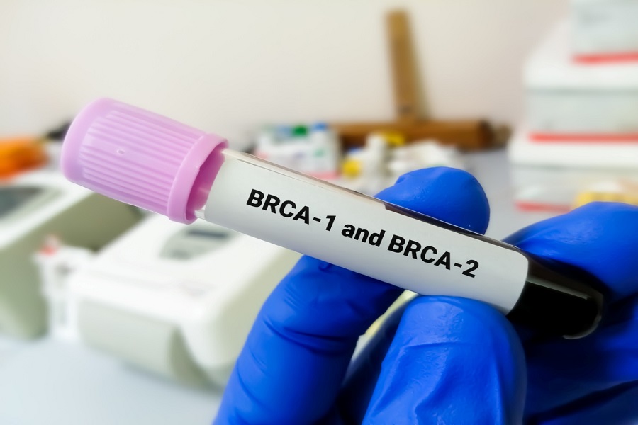 breast cancer genes brca