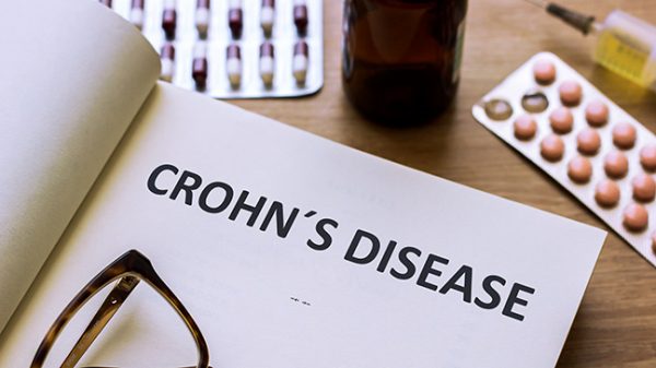 nosos crohn e1697008645975