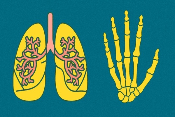 pneumones