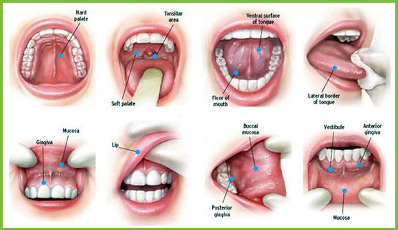 checkingmouthcancer1