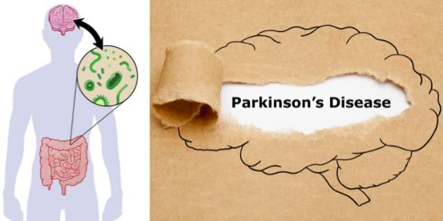 parkinson