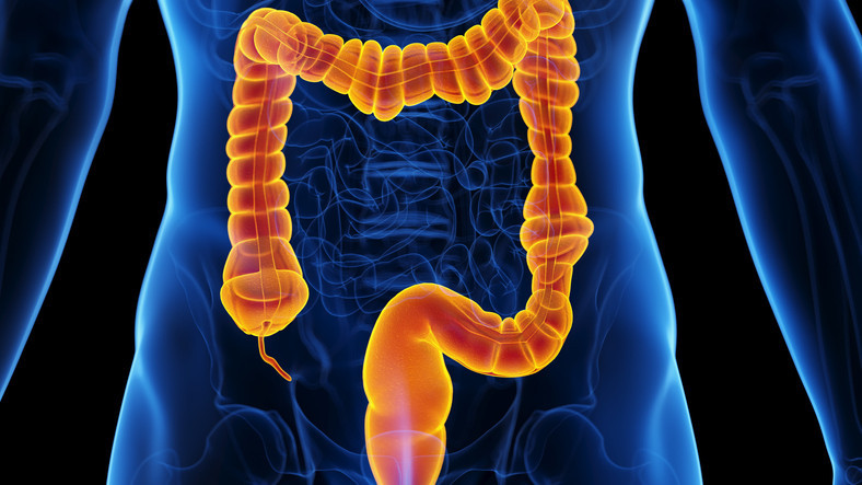 colon cancer b