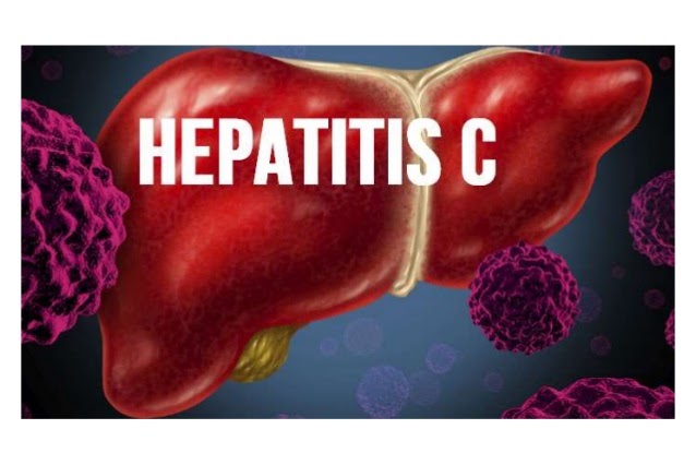 hepatitis c 1