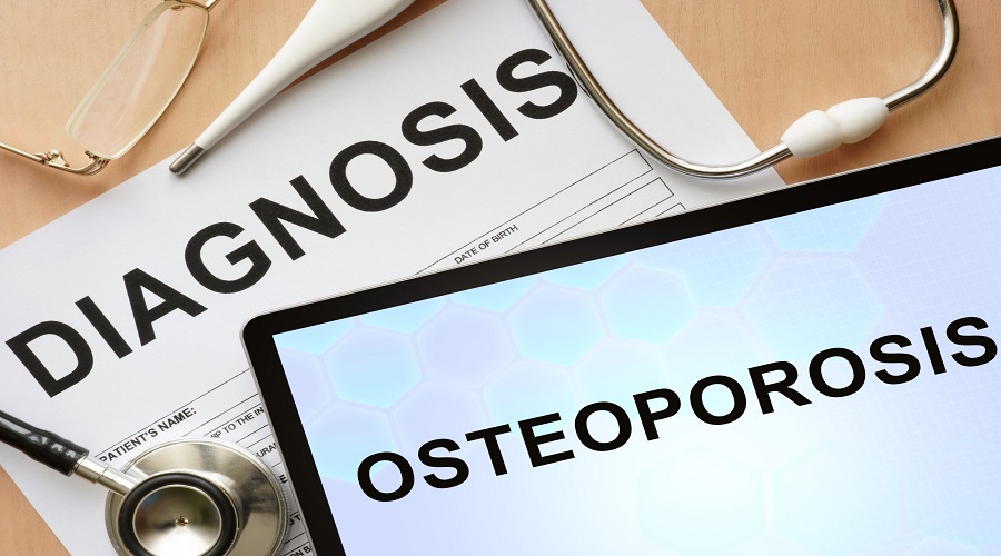 osteoporosi b