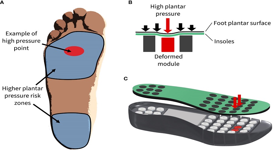 diabetic foot a