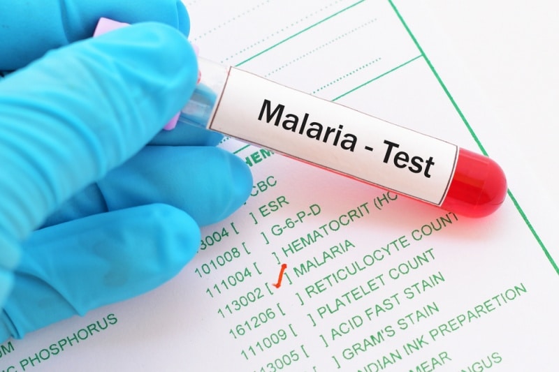 malaria test a