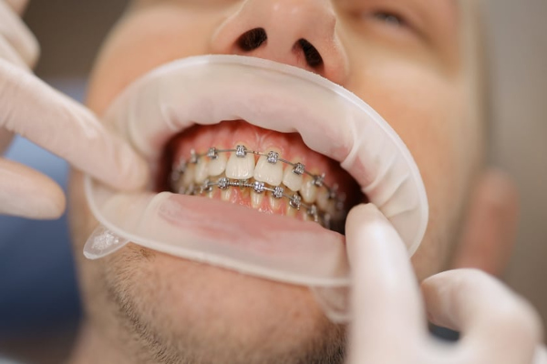 orthodontiki2