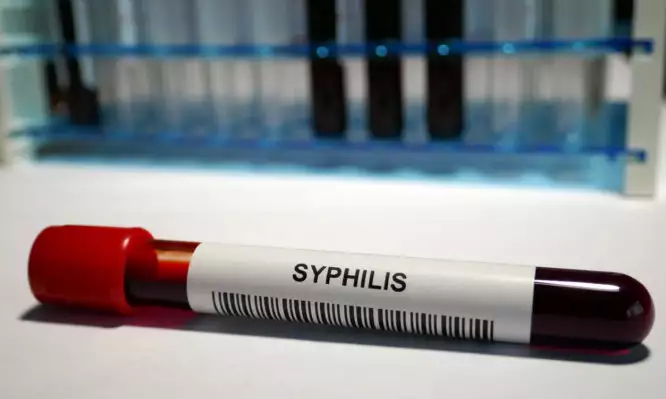 syphilis a