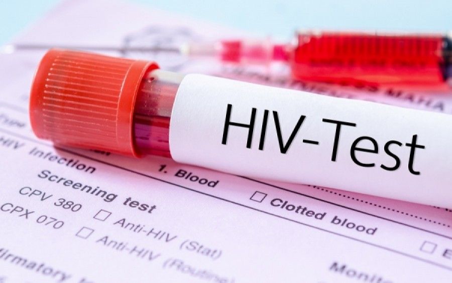 hiv test