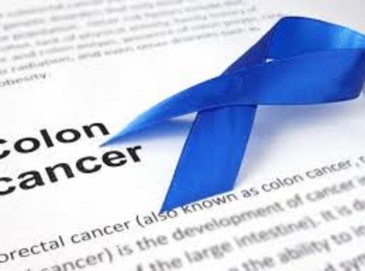 colon cancer