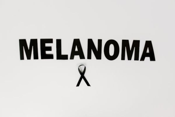 melanoma 2