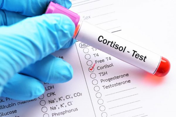 blood test for cortisol e1641457996692