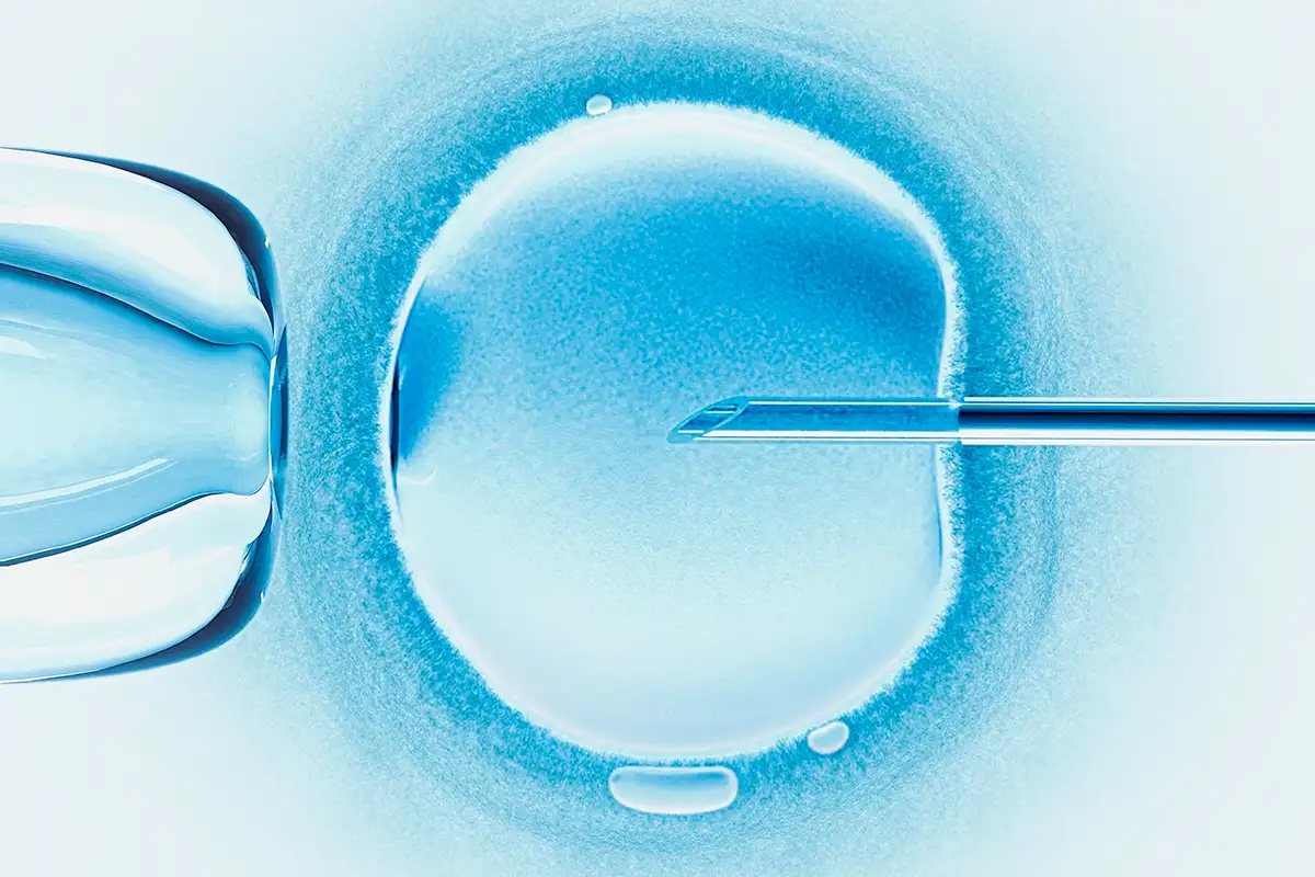 ivf exosomatiki gonimopoiisi